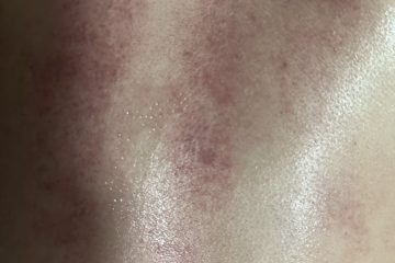 가정용 웰니스를 위한 전동 괄사 기기: 온열 요법, 흡입, 경락 소통, 부항 기능을 갖춘 스마트 마사지기 photo review